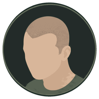 Illustration of a shaved head with a restored hairline created by scalp micropigmentation